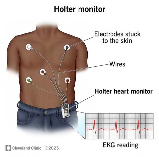 Holter Monitors